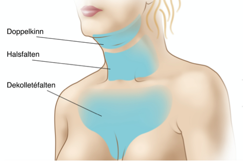 Radiofrequenz strafft Haengebaeckchen